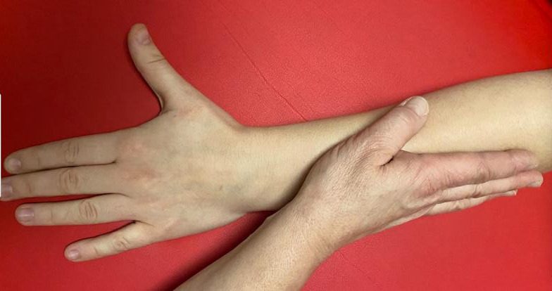 Manuelle Lymphdrainage
